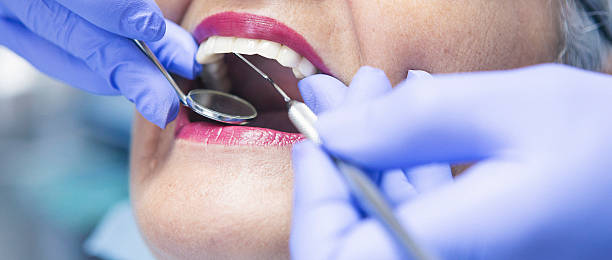 Best Emergency Root Canal Treatment in Clarksville, TN