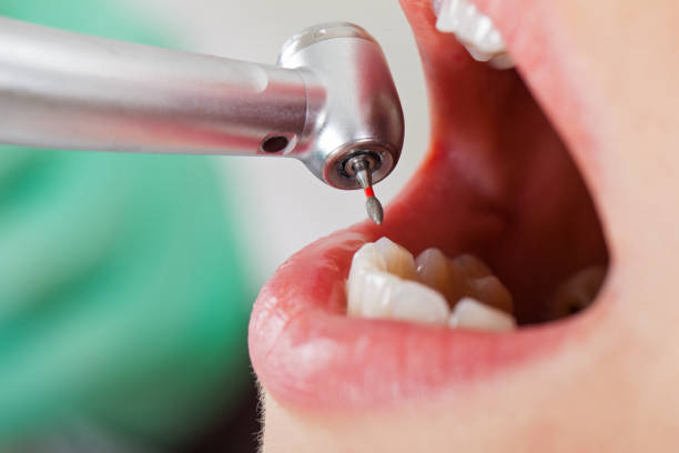 Best Weekend Emergency Dentist in Clarksville, TN